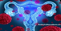 8 Early warning signs of ovarian cancer.
